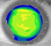 Mappa corneale pre-applicazione
